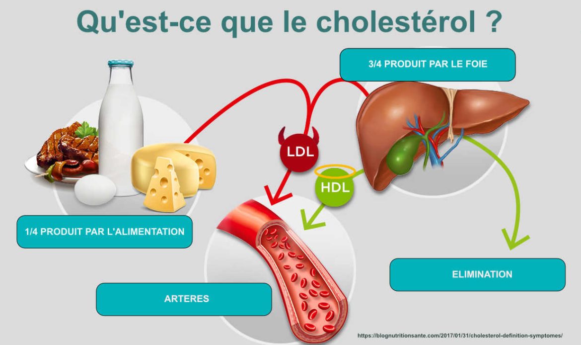 Cholestérol : ces signes sur vos jambes n&rsquo;annoncent rien de bon pour votre santé