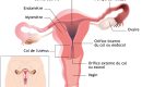 Cancer du col de l&rsquo;utérus : bientôt la fin du frottis ?